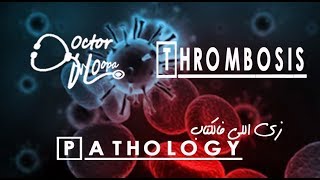 Thrombosis  Pathology زي اللي فالكتاب  Doctor HOopa [upl. by Ymrots892]