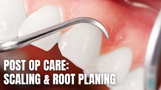 Post Op Care Scaling amp Root Planing [upl. by Yrreg63]