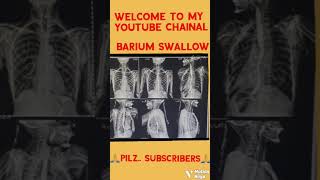 Barium swallow xray radiologi mbbs doctor radiology pilz subscribers reels shourtvidio [upl. by Anattar]