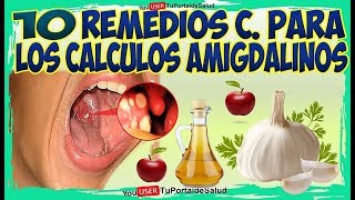 10 Remedios Caseros para Amígdalas  Remedios para los CALCULOS AMIGDALINOS [upl. by Seabury683]