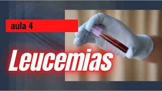 LEUCEMIAS  AULA 4  Hematologia [upl. by Assin278]