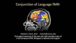 Functional MRI fMRI BOLD imaging  using conjunction display for language mapping [upl. by Amehr]