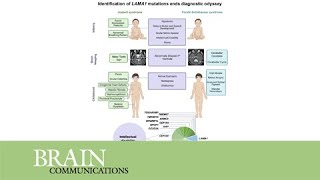 Implications of identification of LAMA1 mutations for patients with presumed Joubert syndrome [upl. by Ylrrad796]