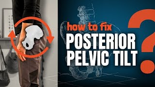 How to Fix Posterior Pelvic Tilt Complete Guide  Exercises [upl. by Savanna993]