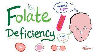 Folate deficiency  Megaloblastic Anemia  Macrocytic  Hematology Series [upl. by Ahsenod]