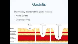 Alterations in Digestive Function [upl. by Hisbe367]