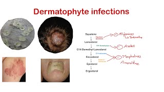 Dermatophytes Ring worm Superficial fungal infection Dermatology [upl. by Evania267]