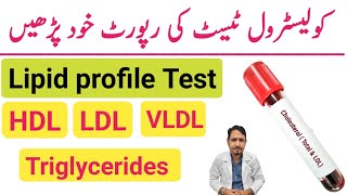 How To Read Cholesterol Test Report Urdu Hindi  Lipid Profile Test  HDL LDL amp Triglycerides Test [upl. by Mascia]