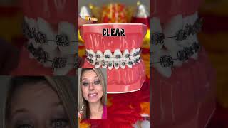 🚨 AVOID THESE BRACES COLORS EXPLAINED 🦷 TIP FOR FALL [upl. by Atikin524]