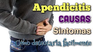 ▶︎ APENDICITIS 5 SINTOMAS 🔥 que NO FALLAN GARANTIZADO👨‍⚕️ [upl. by Najram]