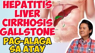 Hepatitis Liver Cirrhosis Gallstone PagAlaga sa Atay  ni Doc Willie Ong 454b [upl. by Ackerman]