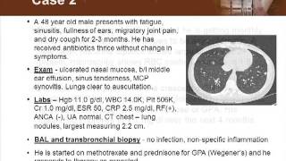 Detecting Vasculitis Before Its Too Late [upl. by Raycher321]