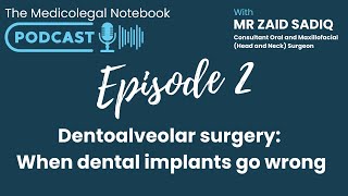 The Medicolegal Notebook Podcast  Series 1 Head and Neck Surgery  Episode 2  Dental implants [upl. by Htederem]