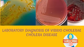 Laboratory diagnosis of Vibrio cholerae in hindi [upl. by Eenaj]