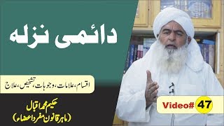 Daimi Nazla ● Video 47 ● دائمی نزلہ ● फ्लू ● Hakeem Muhammad Iqbal [upl. by Erdeid724]