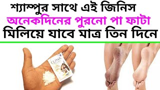 ফাটা পা শ্যাম্পুর সাথে এই জিনিসUse Clinique Plus shampoo to get rid of five years old cracked feet [upl. by Airetak]