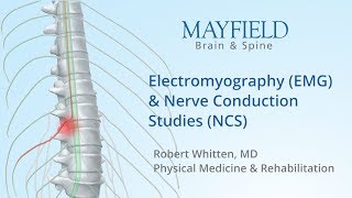 Electromyography EMG amp Nerve conduction studies NCS [upl. by Kalvn]