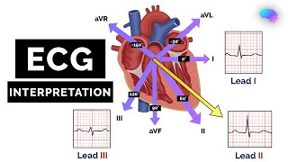 How to Read an ECG  ECG Interpretation  EKG  OSCE Guide  UKMLA  CPSA [upl. by Hayouqes]