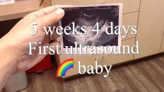 First Ultrasound at 5 weeks 4 days  Expecting after miscarriage  Life with Brittany [upl. by Mitman]