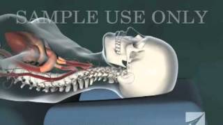 Cervical Chiropractic Adjustment [upl. by Farhi773]