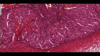 Histology of the Corpus Luteum 4K [upl. by Roselle]