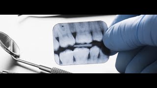 Dental Radiology Lecture 4 Processing Dental Xray Film [upl. by Bunns]