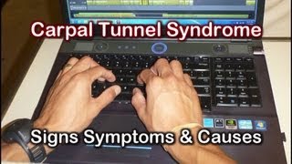 Carpal Tunnel Signs Symptoms amp Causes of Carpal Tunnel Syndrome [upl. by Dirfliw904]