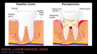 What is the difference between and endodontist and a periodontist [upl. by Emalia]