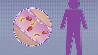 Detecting Nasopharyngeal Carcinoma in Asymptomatic Persons [upl. by Haleehs]