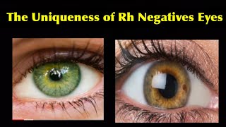 The Uniqueness of Rh Negatives Eyes [upl. by Gratia]