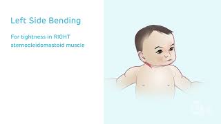 Congenital Muscular Torticollis Stretching [upl. by Ettari]