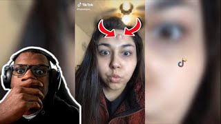 Pimple Popping TikTok Compilations FOR 12 MINUTES [upl. by Constant94]