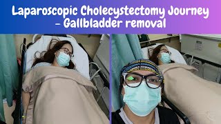 LAPAROSCOPIC CHOLECYSTECTOMY  Gallbladder removal surgery [upl. by Trescha]