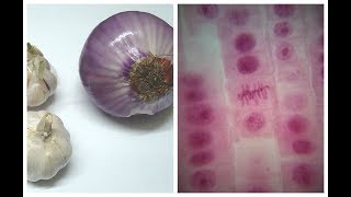 Mitosis in Onion Root tip Experiment [upl. by Lorie796]