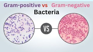 Gramnegative vs grampositive bacteria Difference between Gram ve and Gram ve bacteria [upl. by Pascoe]