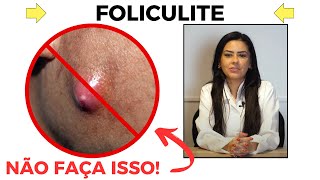 COMO EVITAR A FOLICULITE REVELADO [upl. by Suiradel]