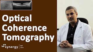 What is OCT How Optical Coherence Tomography Works I Retinal disease evaluation tool [upl. by Alton]