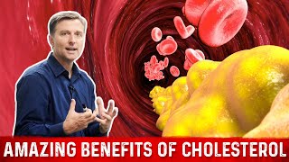 Cholesterol Function – Amazing Benefits of Cholesterol – Dr Berg [upl. by Nanaj150]