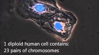 A microscopic view of a buccal swab sample for DNA analysis [upl. by Eisnil675]