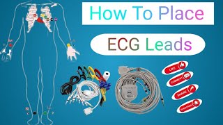 How to place ECG Leads on patients ECG Leads Placement  12 leads ECG acquisition system [upl. by Suivat]