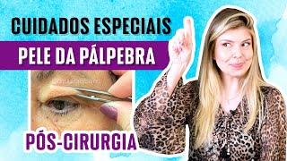 Cuidados especiais no pósoperatório de blefaroplastia [upl. by Stephana601]