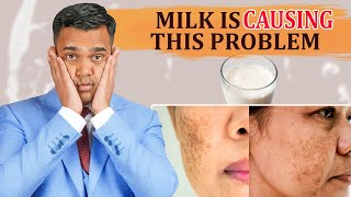 Milk Is Causing Pigmentation AcneIndigestion And Constipation  Dr Vivek Joshi [upl. by Swisher658]