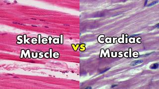 Differentiating Skeletal Muscle and Cardiac Muscle  Striations vs Intercalated Discs [upl. by Jesh]