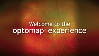 Optomap Comparision [upl. by Catie]