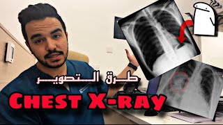 شرح كامل لوضعيات Chest Xray 🫁 [upl. by Intruoc]