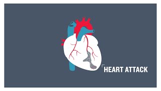 Heart attack clogged arteries and atherosclerosis [upl. by Blumenthal]