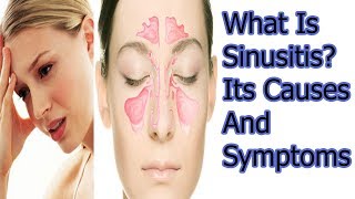 what is Sinusitis Its Causes And Symptoms [upl. by Vil]