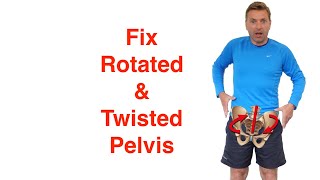 Best Rotated Pelvis Correction Exercises [upl. by Swihart506]