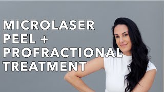 MicroLaser Peel and Profractional Treatment  Nazarian Plastic Surgery [upl. by Isidor]