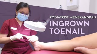 Podiatrist Menerangkan Ingrown Toenail  Ari Tria Singapore Podiatrist [upl. by Naesar]